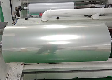 Hospital printing Screen Printing Film for Colour Doppler Ultrasound / CT results